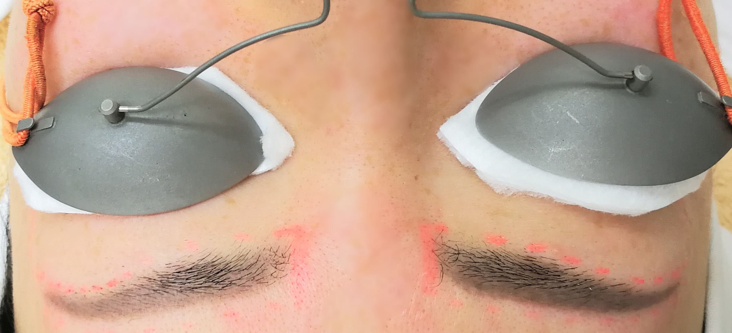 アートメイクをされている方にオススメ 眉毛まわり ギリギリまで脱毛体験記 きらひび 旅行記や食べ歩きグルメ クレジットカードなどの雑記ブログ